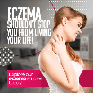 Eczema shouldn't stop you from living your life